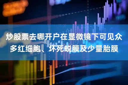 炒股票去哪开户在显微镜下可见众多红细胞、坏死蜕膜及少量胎膜